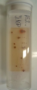 Obr. 1 Deskov otopn tleso v hygienickm proveden a z nho odebran a vykultivovan vzorky bakteri (na lut destice) a plsn (na rov destice) na chodb koln budovy