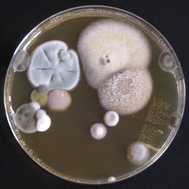 Obr. č. 5a. – Ukázka již kultivovaných vzorků na Petriho miskách: plísně
