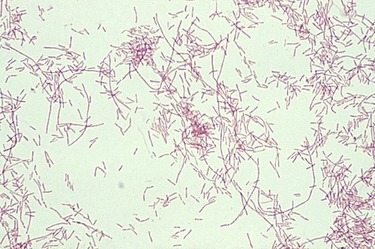 Obrzek 1: Legionella pod mikroskopem po Gramov barven