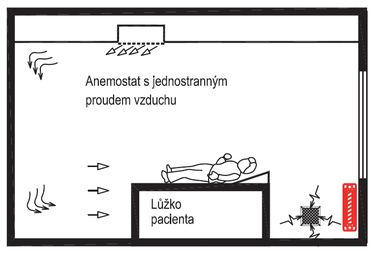 Obr. 13 Příklad náhrady vířivého anemostatu nad nemocničním lůžkem anemostatem s jednostranným proudem vzduchu
