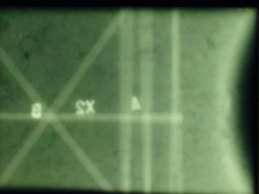 Obrázek 2b.: Detail radiogramu kde je zjevná absence kruhové výztuže s radiálními pruty.
