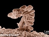 Výskyt koliformních bakterií ve vodě - mohou vznikat i rozkladem listí ve studni, Escherichia coli, foto Euroclean