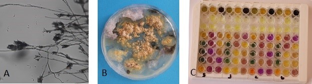 Obrázek 2: A – Penicillium sp. pod mikroskopem, zvětšení 400x, B – růst plísní na Petriho misce s živnou půdou a vzorkem omítky, C – mikrotitrační deska s biochemickými reakcemi pro identifikaci bakterií