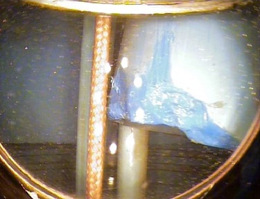 Foto 8: Deformace pažnice v hloubce 53 m způsobené čerpadlem, boční pohled