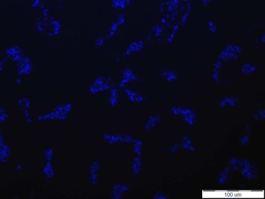 Obr. 2a: Signl senzorov molekuly zaloen na C-glykosidu manno konfigurace s BDP k bukm Escherichia coli. Buky E. coli CCM 3954 zviditelnn fluorescenn sondou DAPI