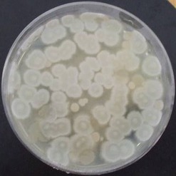 Obr. 1. Vzhled a morfologie koloni streptomycet na zkouench mdich – S mdium