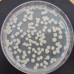 Obr. 1. Vzhled a morfologie koloni streptomycet na zkouench mdich – B mdium