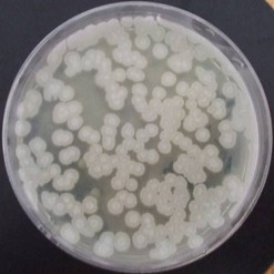 Obr. 1. Vzhled a morfologie koloni streptomycet na zkouench mdich – SM mdium