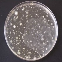 Obr. 2b – Příklad organické kontaminace vzduchu koloniemi bakterií a plísní