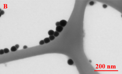 Obr. 4b: Se nanočástice z elektronového mikroskopu (STEM) SeNP ve dvou různých zobrazovacích polích: B) 1,04 μm. Průměrná velikost částic SeNP je ≈ 45 nm (VUT Brno)