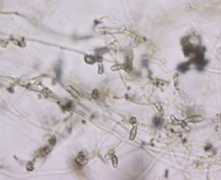 Obr. 2c Príklady organizmov v pitných a povrchových vodách – mikromycéty