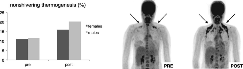 Obr. 2 Netesov termogeneze (nonshivering thermogenesis) a aktivita hndho tuku v tle dosplho (ipky) ped (PRE) a po (POST) aklimatizaci na chlad [1]