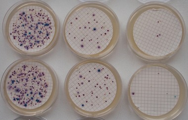 Obr. 1. Stanoven koliformnch bakteri a Escherichia coli na chromogennm mdiu