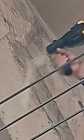 Obr.&nbsp;4: Endoskopia sp�nan�ch v�zn�kov: a)&nbsp;v�tanie pr�klepovou v�ta�kou