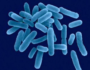 Jak se vypodat s bakteri Legionella, likvidace Euroclean